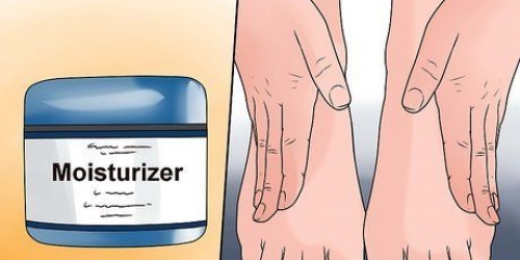 Trate o eczema de inverno