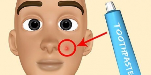 Faça seu próprio tratamento para acne