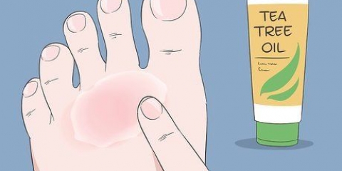 Curar o eczema do nadador: pode ser feito naturalmente?