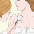 Livre-se das cicatrizes de acne no peito