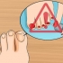 Livre-se das unhas amarelas