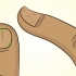 Curar unhas danificadas