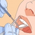 Tratando um dente solto
