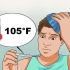 Tratando um dente do siso inflamado
