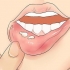 Reconhecendo o herpes