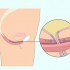 Faça exercícios de kegel