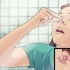 Tratamento de herpes labial no nariz