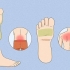 Tratando a dor nas costas com reflexologia