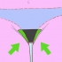 Remova os pelos pubianos ao redor da vagina
