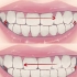 Pare de ranger os dentes enquanto dorme